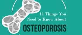 Understanding Osteoporosis: 11 Things You Should Know About Brittle Bones